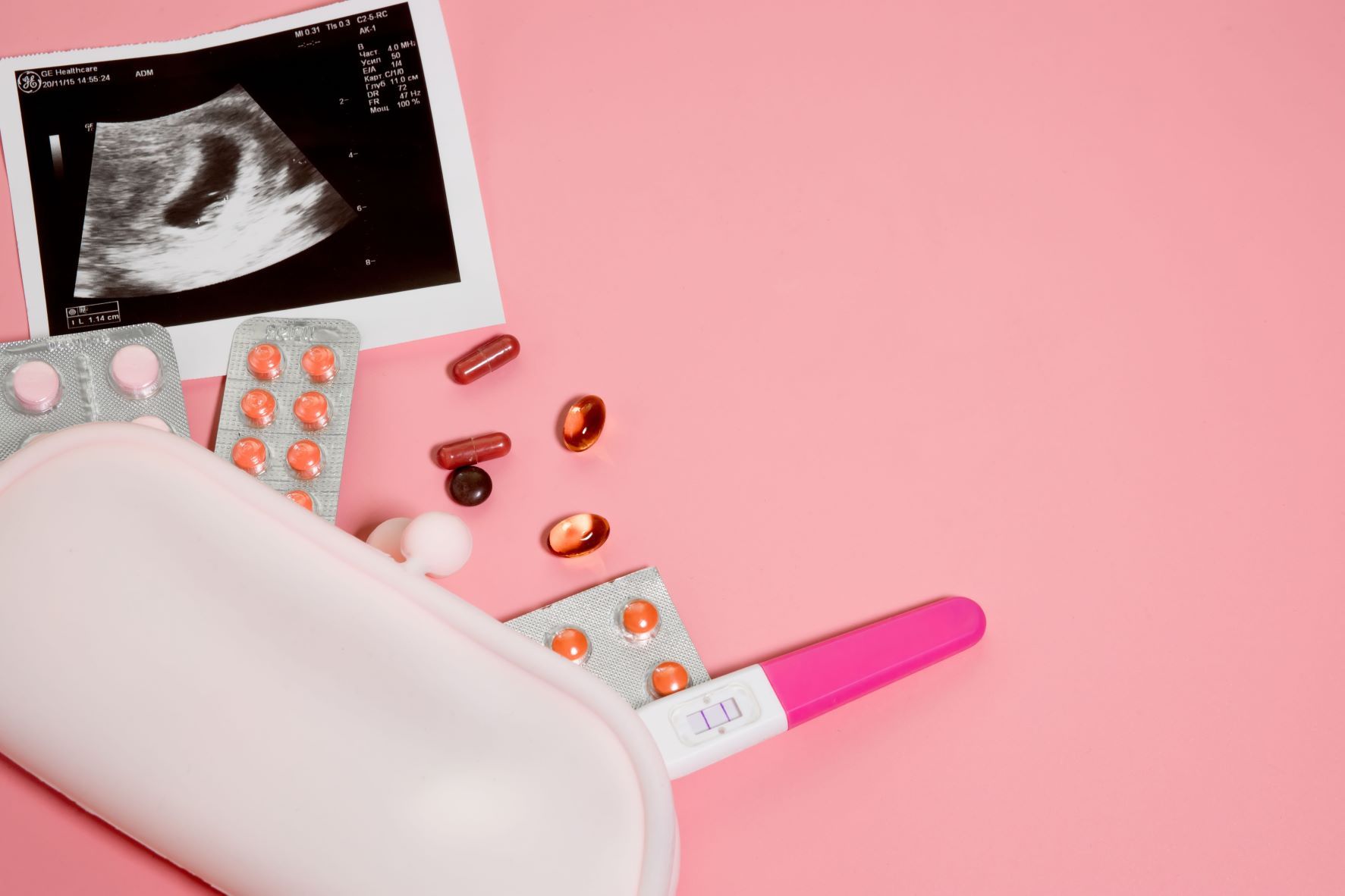 Bezpieczeństwo stosowania leków u kobiet w ciąży. Farmakoterapia zaburzeń psychotycznych