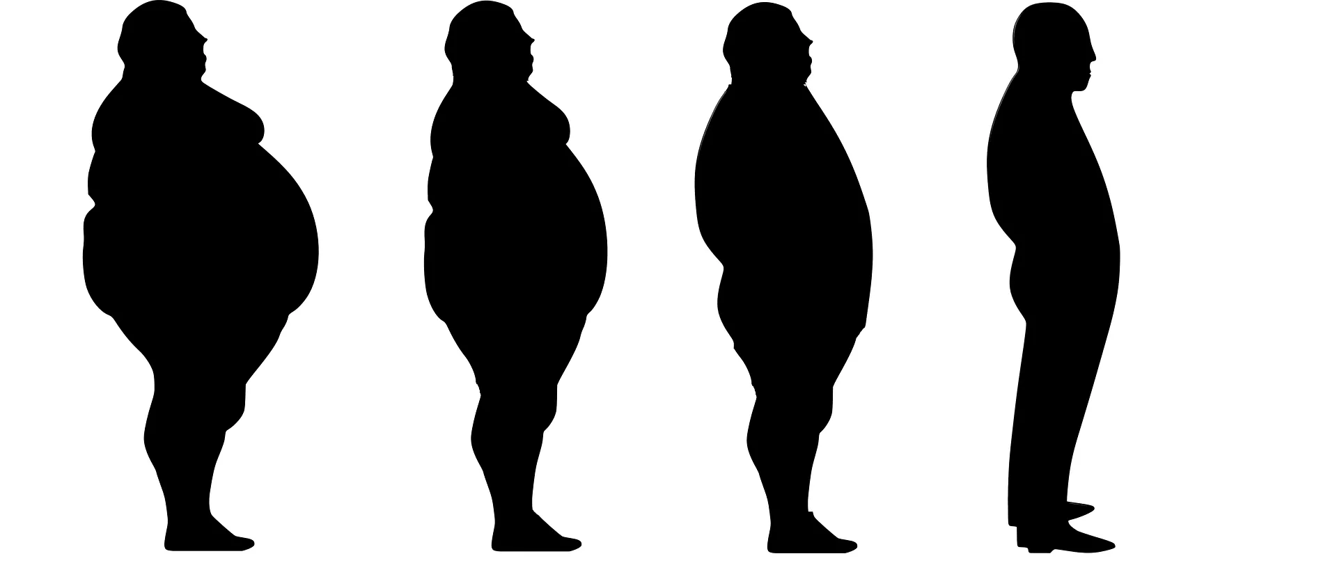 MZ opublikowało rozporządzenie w sprawie leczenia otyłości olbrzymiej KOS-BAR