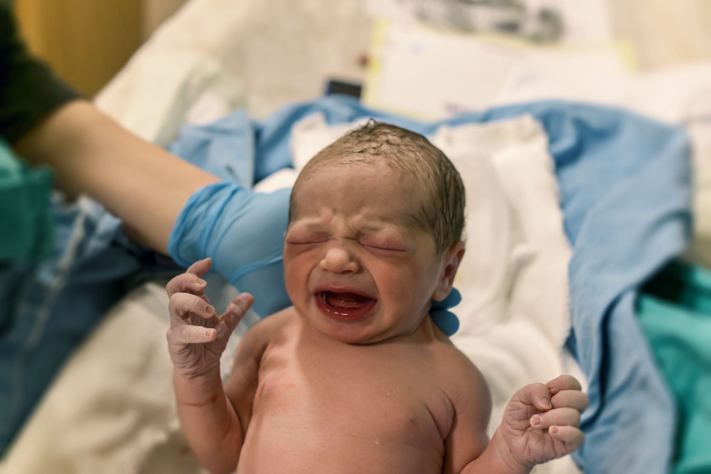 Wady wrodzone noworodków objętych perinatalną opieką paliatywną